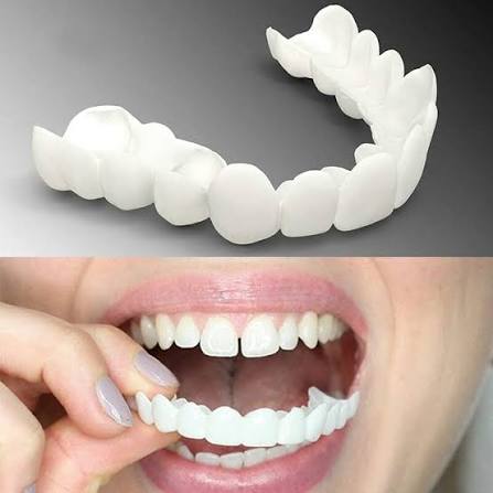 Snap on Smile Teeth Whitening Veneers (Perfect Smile)