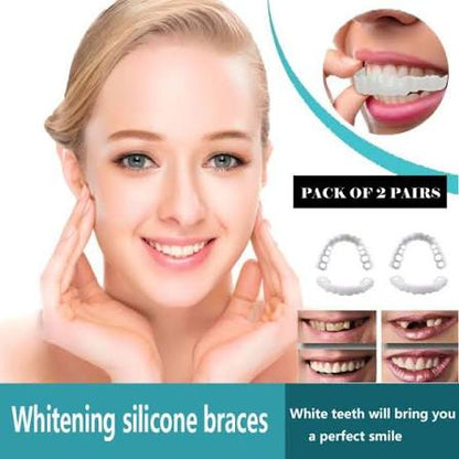 Snap on Smile Teeth Whitening Veneers (Perfect Smile)