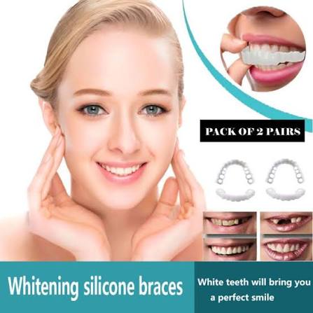 Snap on Smile Teeth Whitening Veneers (Perfect Smile)