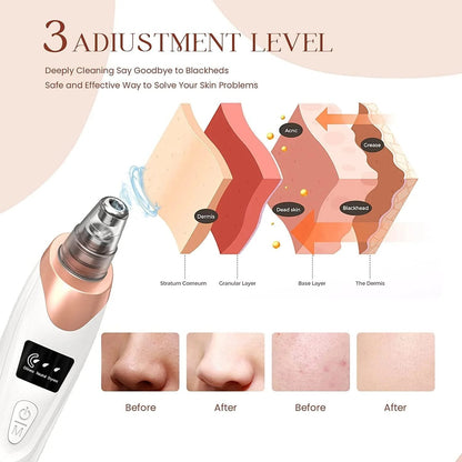 5 in 1 Electric Rechargeable Black Head Remover Machine
